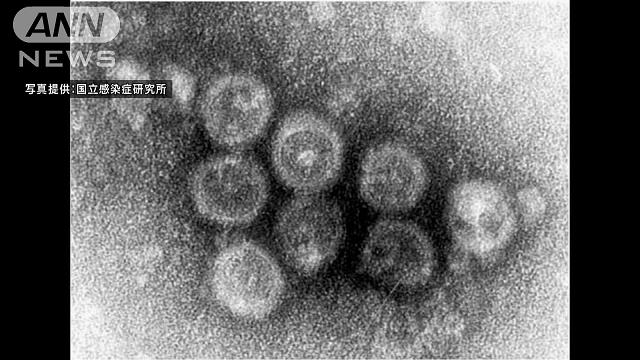 風疹の流行がさらに拡大　今年に入ってから184人に[2018/08/28 23:36]