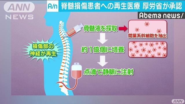 世界初 患者自身の骨髄液から神経再生の治療法承認