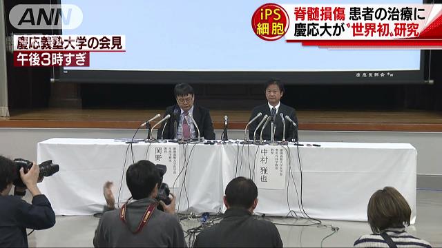 Ips細胞で脊髄損傷を治療へ 慶応大の臨床計画了承 テレ朝news テレビ朝日のニュースサイト