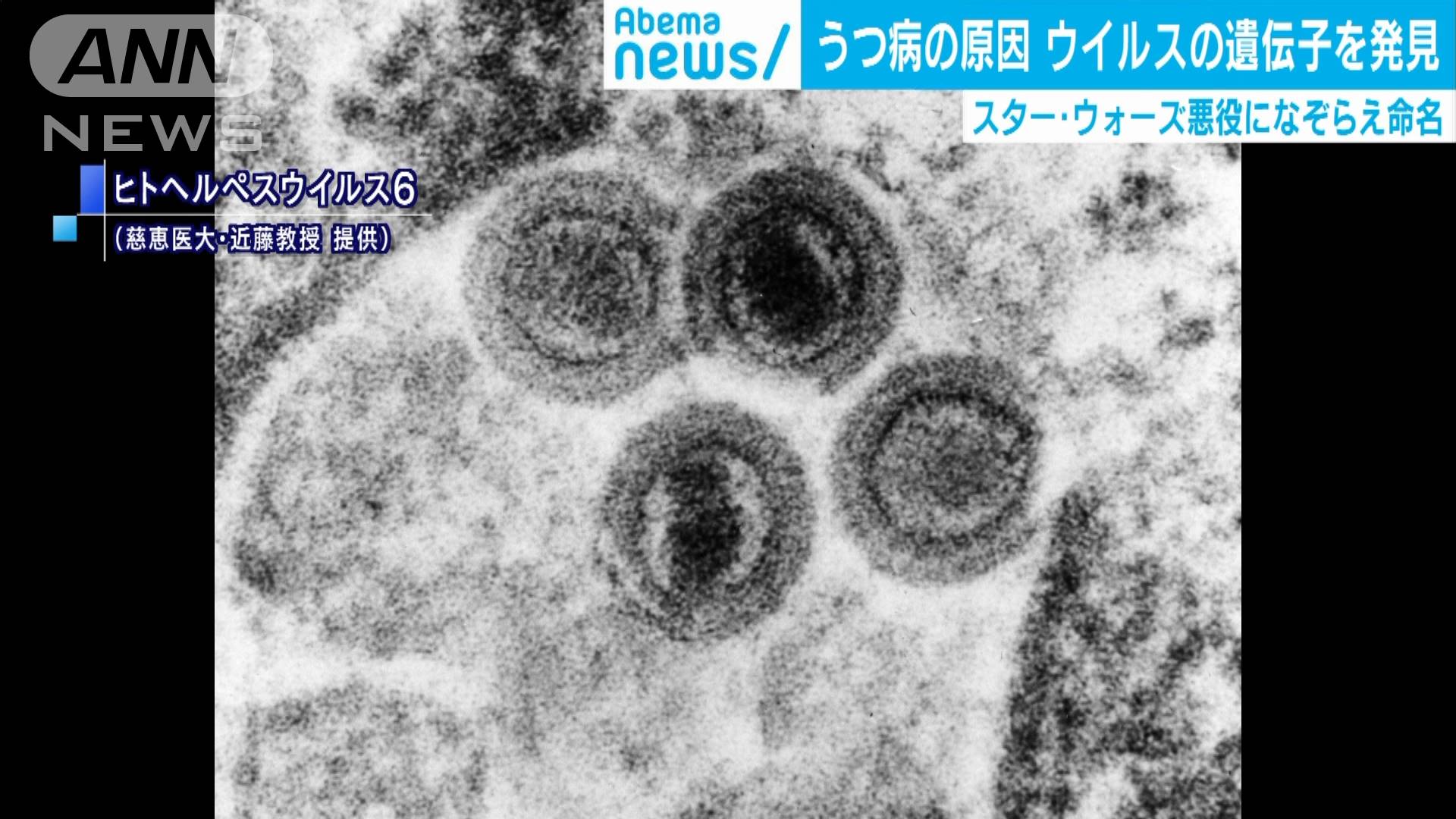 うつ病の原因 となるウイルスの遺伝子を発見 テレ朝news テレビ朝日のニュースサイト