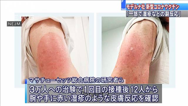 2回目の投与は必要ですか?
