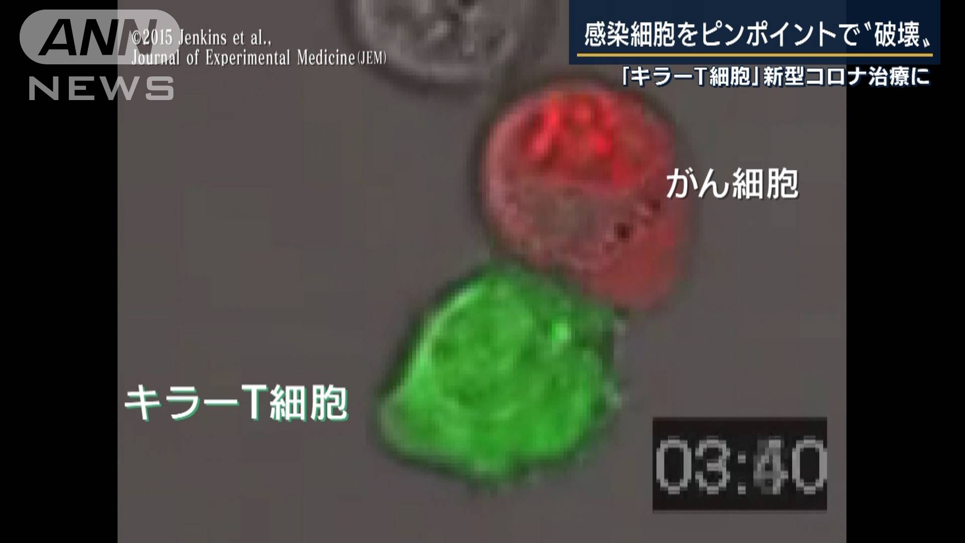 世界初 キラーt細胞でコロナ治療 キーマンに聞く テレ朝news テレビ朝日のニュースサイト