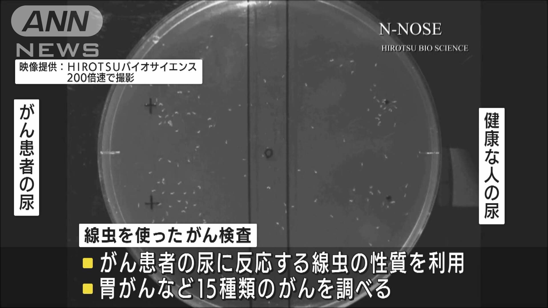 尿1滴で 線虫がん検査の拠点が新宿にオープン テレ朝news テレビ朝日のニュースサイト