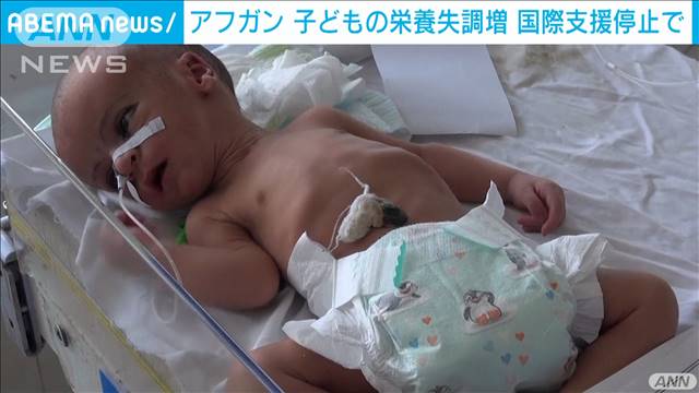 アフガンで栄養失調の子ども増加 国際支援停止で テレ朝news テレビ朝日のニュースサイト