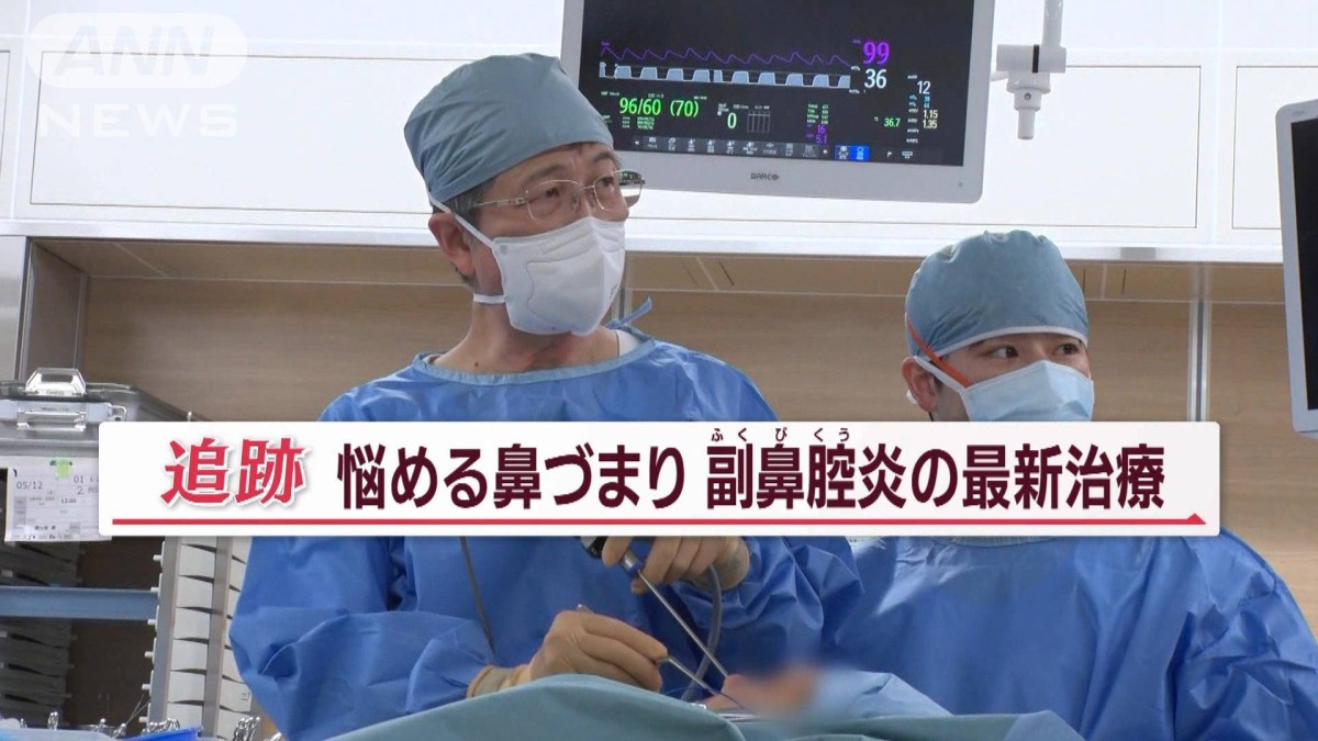 副 鼻腔 炎 手術 し て 良かっ た