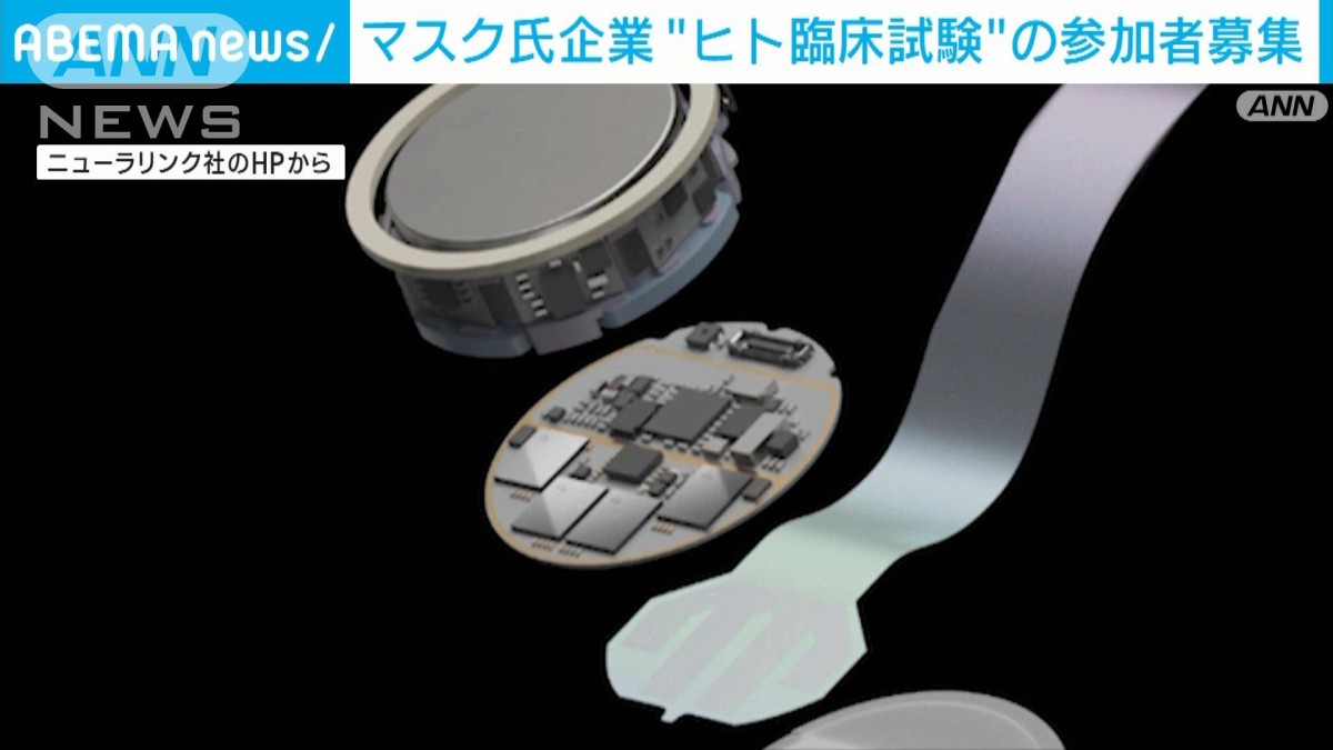 マスク氏の医療ベンチャー　“脳内チップ”埋め込み　初のヒト臨床試験で参加者募集へ