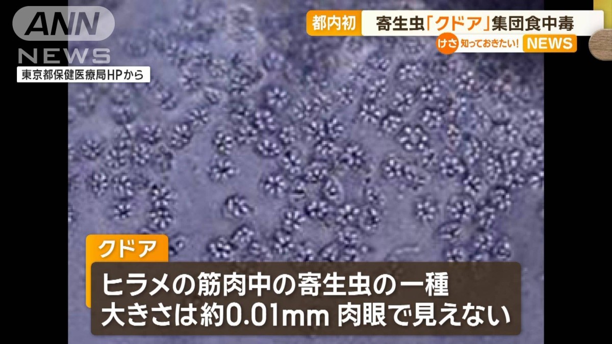 寄生虫「クドア」による集団食中毒 都内で初