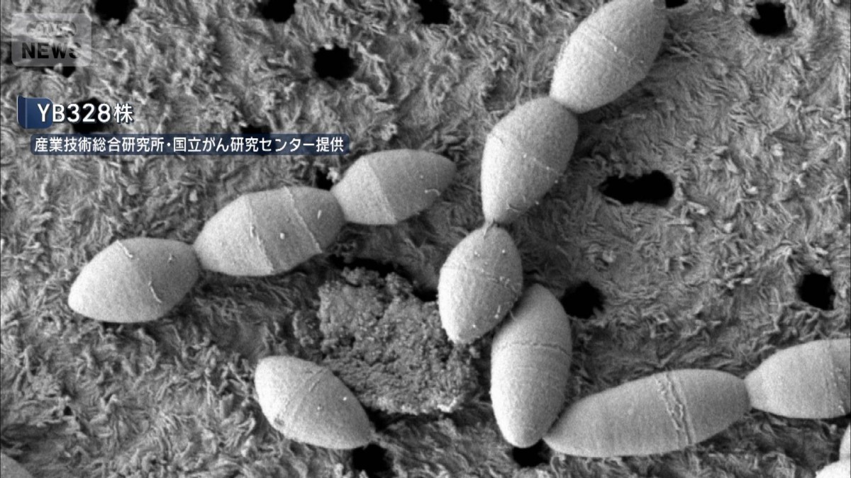 がん治療効果高める腸内菌発見 国立がん研究センターなどが発表