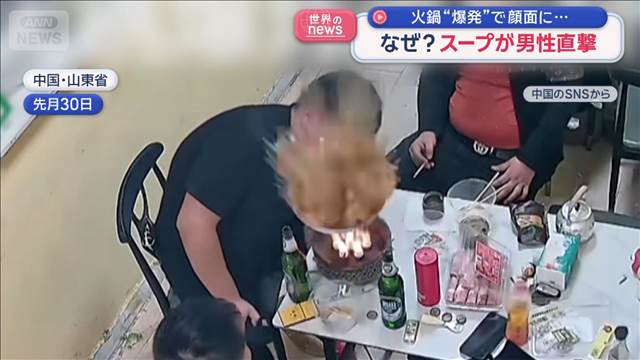 火鍋“爆発”で顔面に…　なぜ？スープが男性直撃　中国・山東省
