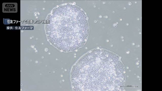 【速報】iPS細胞使った再生医療2製品　厚労省の専門部会が製造販売を了承　世界初へ