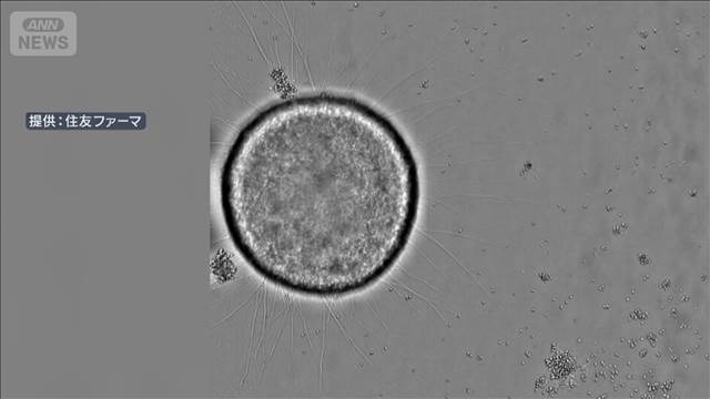 世界初の製品誕生へ　厚労部会がiPS細胞の再生医療製品の製造販売を了承