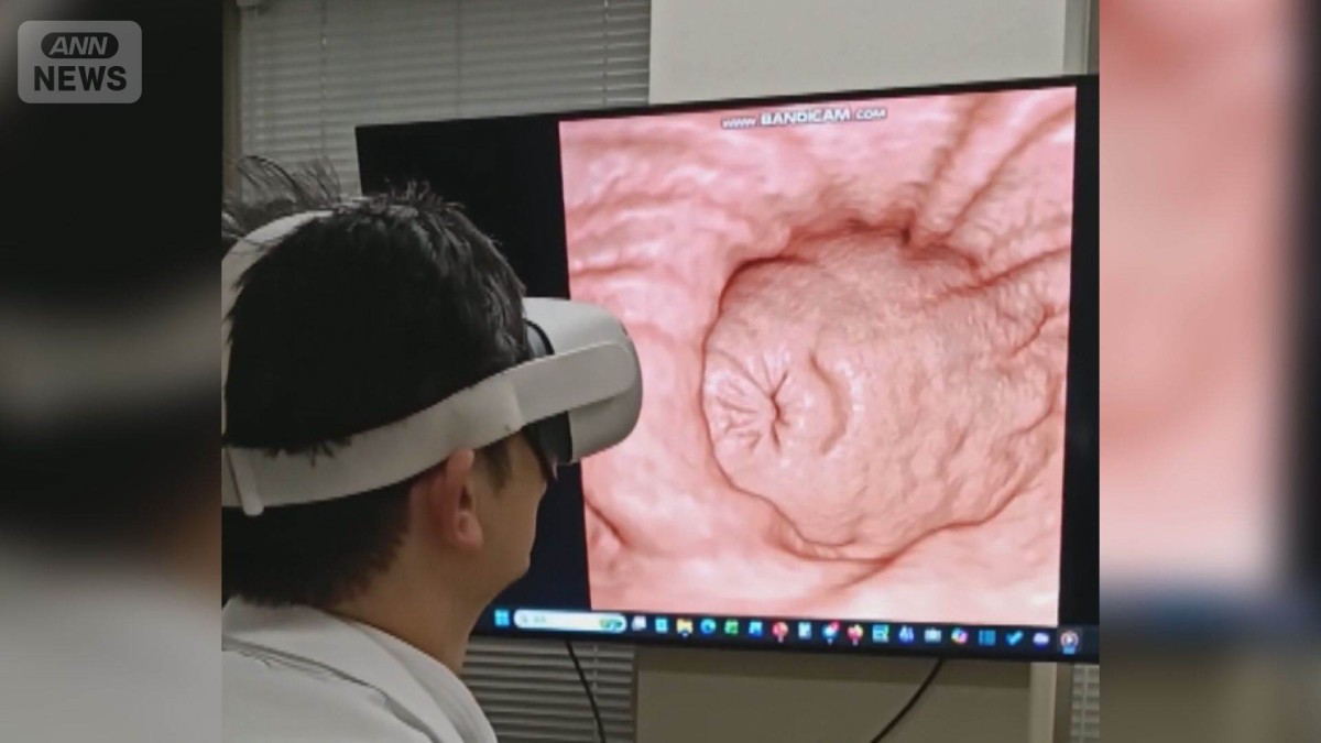 胃カメラ・バリウム不要　苦痛の少ないがん検診　VRゴーグルで直接観察するように検査