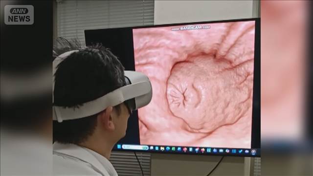 胃カメラ・バリウム不要　苦痛の少ないがん検診　VRゴーグルで直接観察するように検査