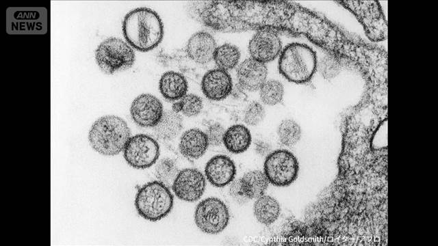 3人死亡　WHOが注意…日本は1999年以降感染なし