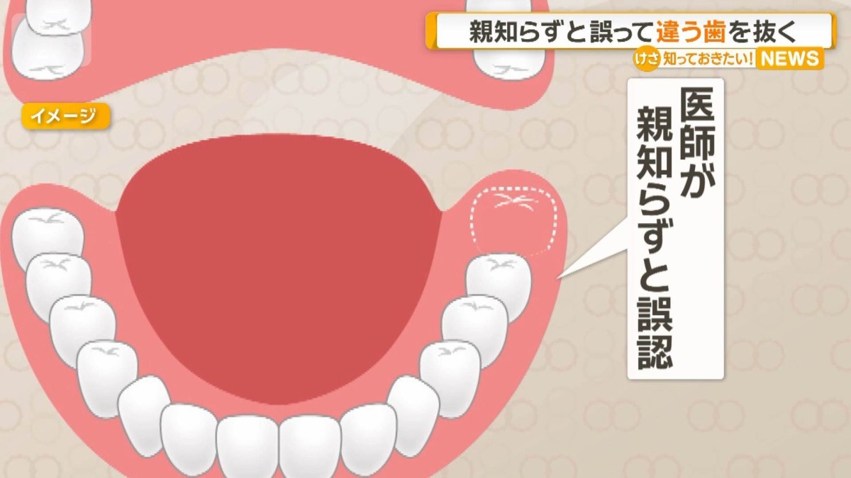 親知らず なん j