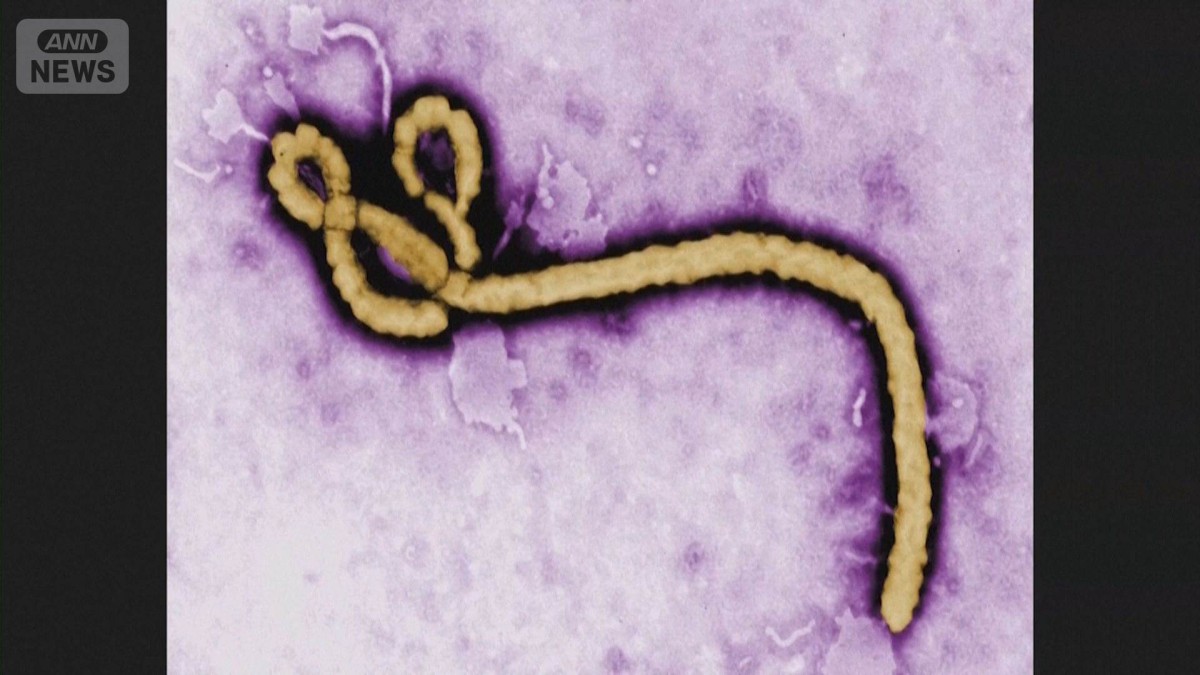 エボラ出血熱に米国人1人が感染　CDCが入国制限も　W杯代表の対策も検討