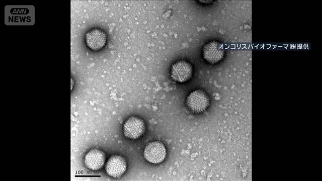 世界初の食道がん治療薬を了承　「ウイルス」でがん細胞を破壊