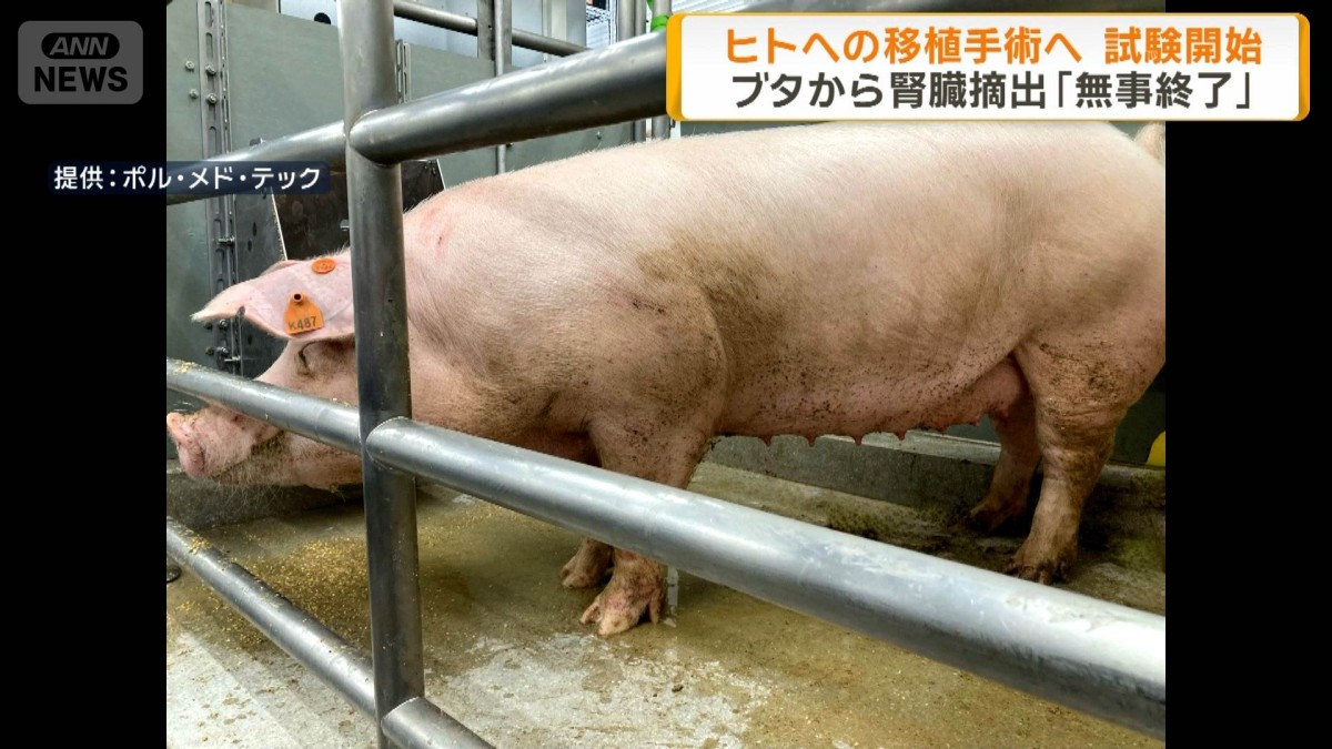 ブタから腎臓摘出の試験開始　再来年予定 ヒトへの移植手術