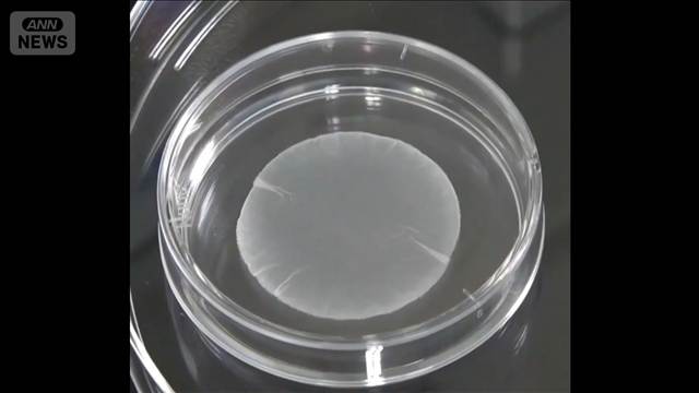 iPS細胞由来の再生医療製品2例目の実用化へ　心臓治療「リハート」の保険適用決定