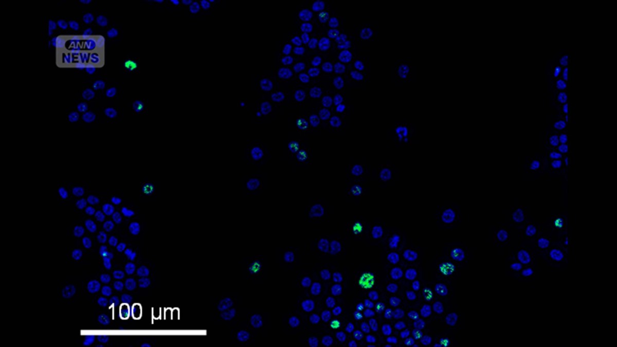 タウリンが「老化細胞」を除去　大正製薬が研究成果を発表