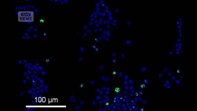 タウリンが「老化細胞」を除去　大正製薬が研究成果を発表