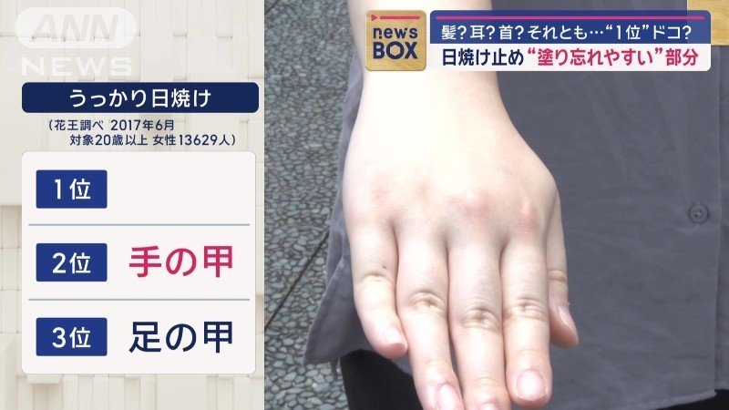 第2位は「手の甲」