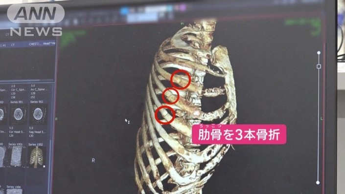 大事には至らず