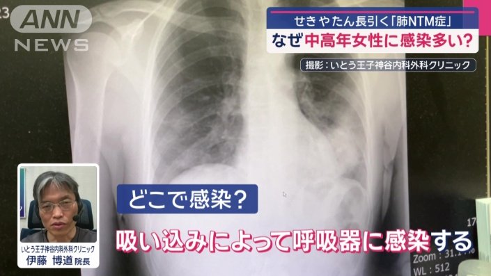 「吸い込みによって呼吸器に感染する」