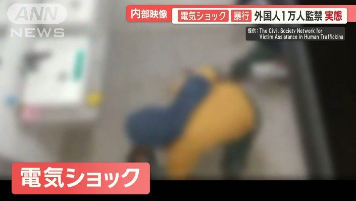 電気ショックも