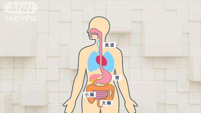 自走式カプセル内視鏡