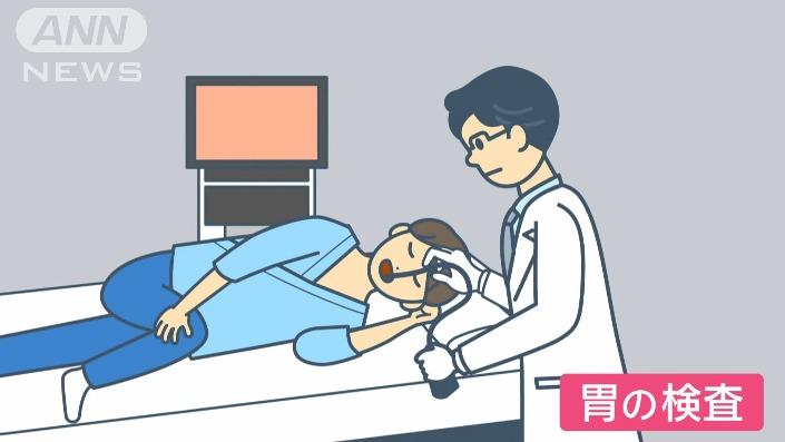 痛くない胃の検査