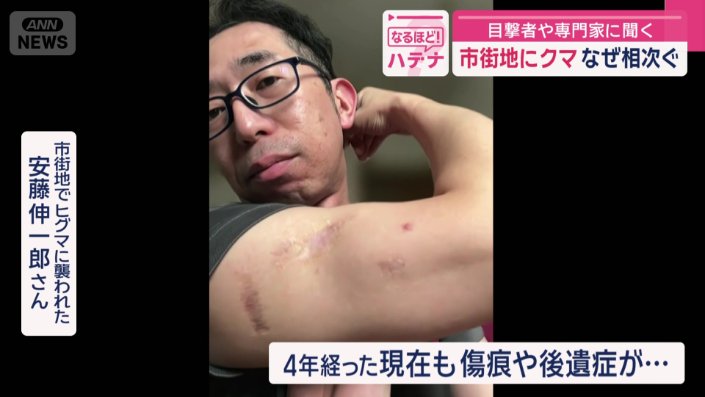 ひざの後遺症にも苦しんでいる