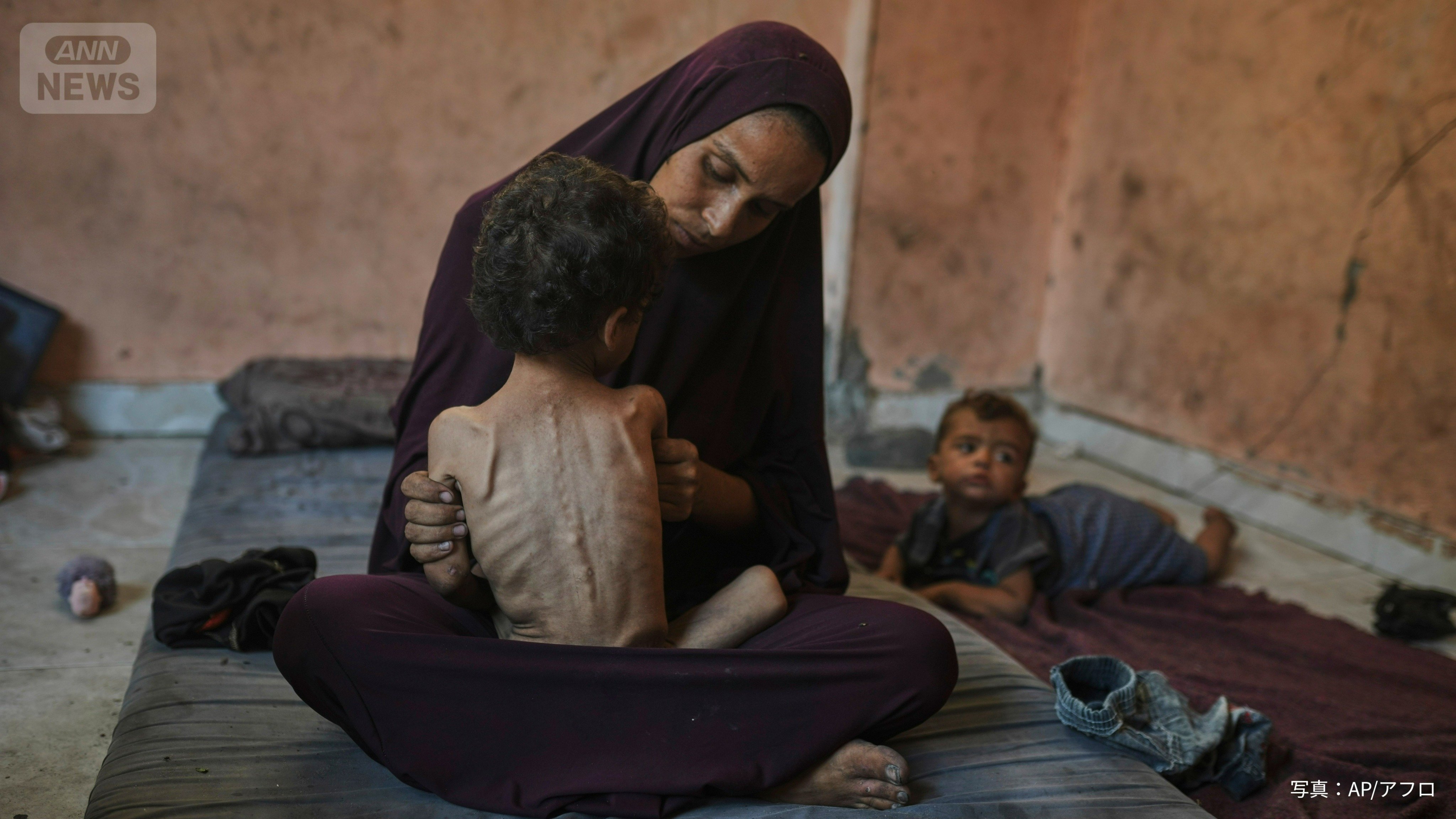 やせ細った子どもを抱く母親（写真：AP/アフロ）