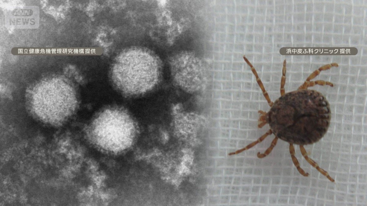 「森の吸血鬼」マダニ感染症が急拡大　致死率30％も　131人感染13人死亡