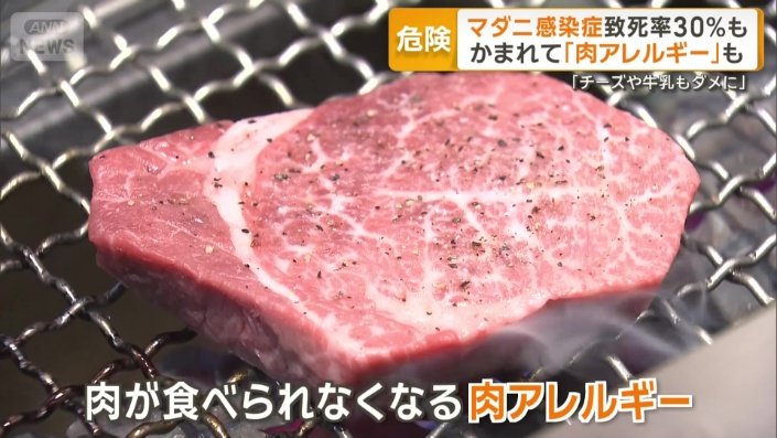 かまれて「肉アレルギー」発症も