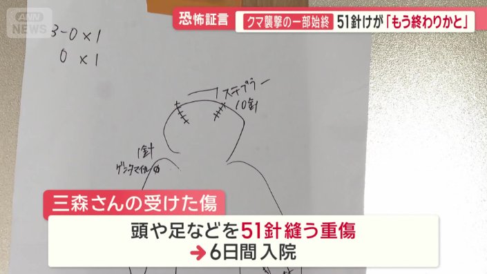 頭や足などを51針縫う重傷を負い6日間入院