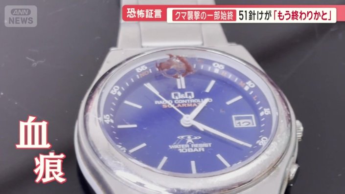 ベルトがはずれた腕時計には血の痕
