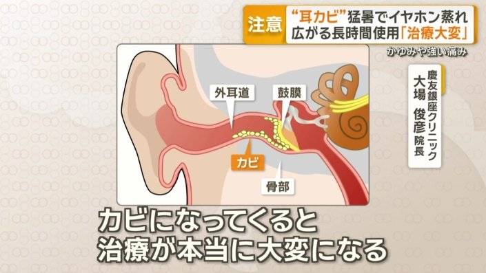 「カビになってくると、治療が本当に大変になる」