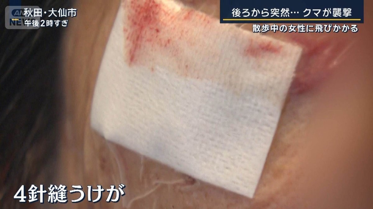 散歩中の女性に飛びかかる…襲われる瞬間の映像　クマが人の顔を狙う理由