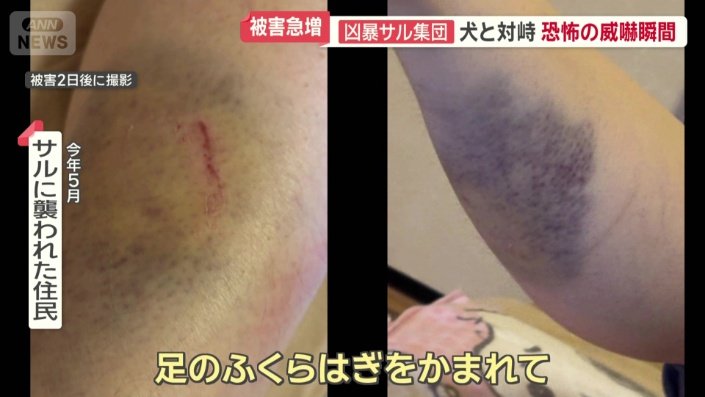 「痛みもまだ全く消えてはなく」