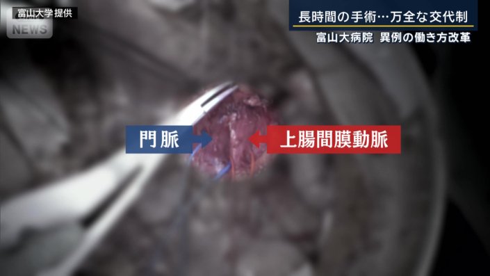 すい臓を切除しやすく