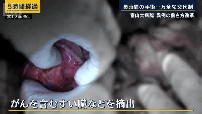 がんを含むすい臓などを摘出