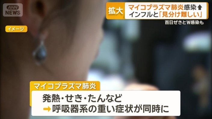 マイコプラズマ肺炎