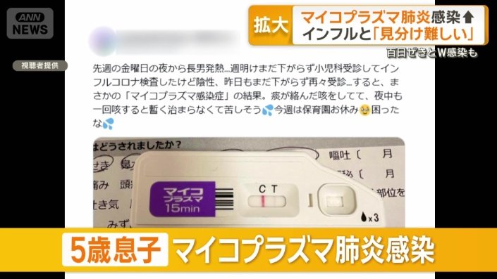 5歳の息子がマイコプラズマ肺炎感染