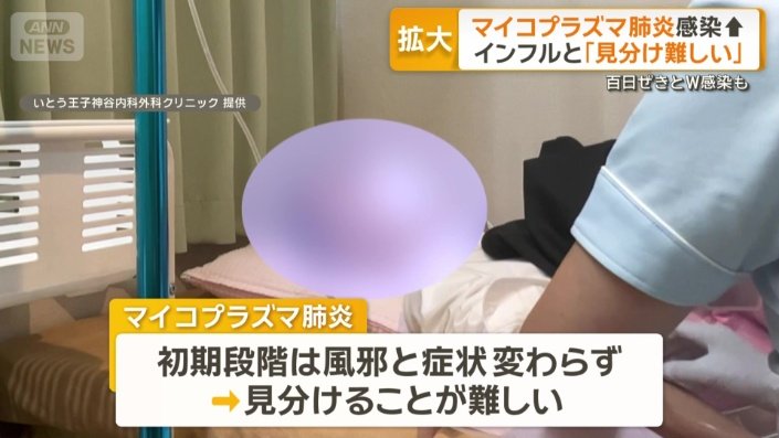 初期段階は風邪と見分けることが難しい