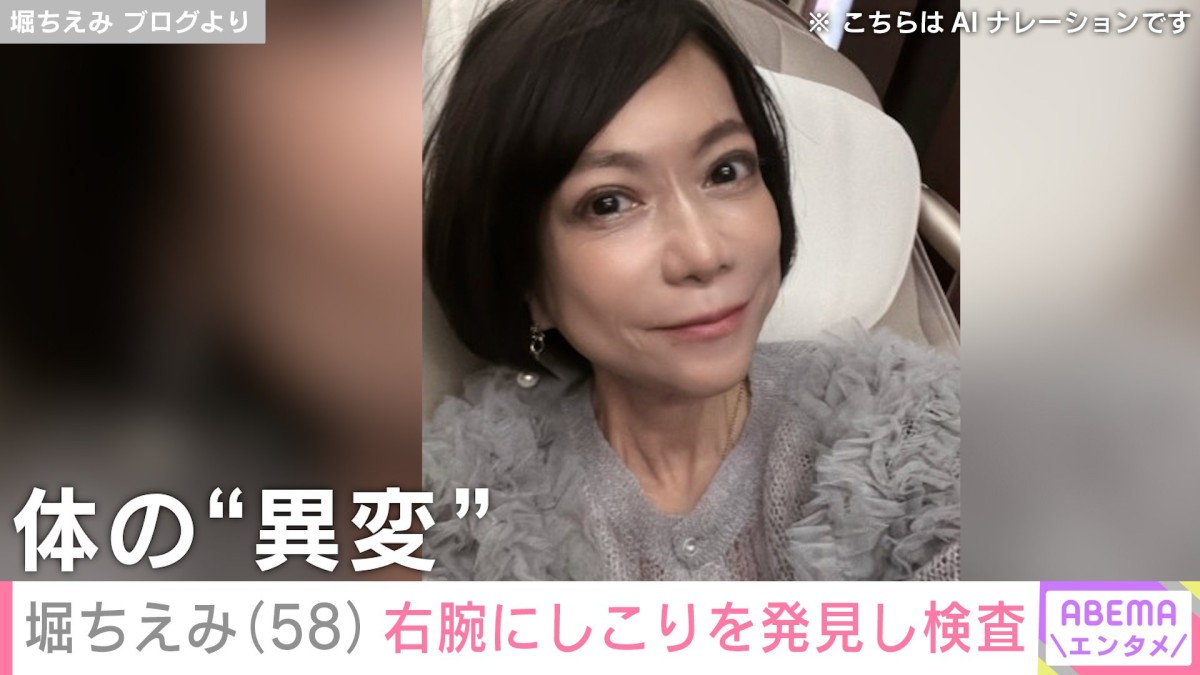 2024年に舌がん完治・堀ちえみ(58)、右腕に5ミリほどのしこりを発見し検査「コリコリしているような」