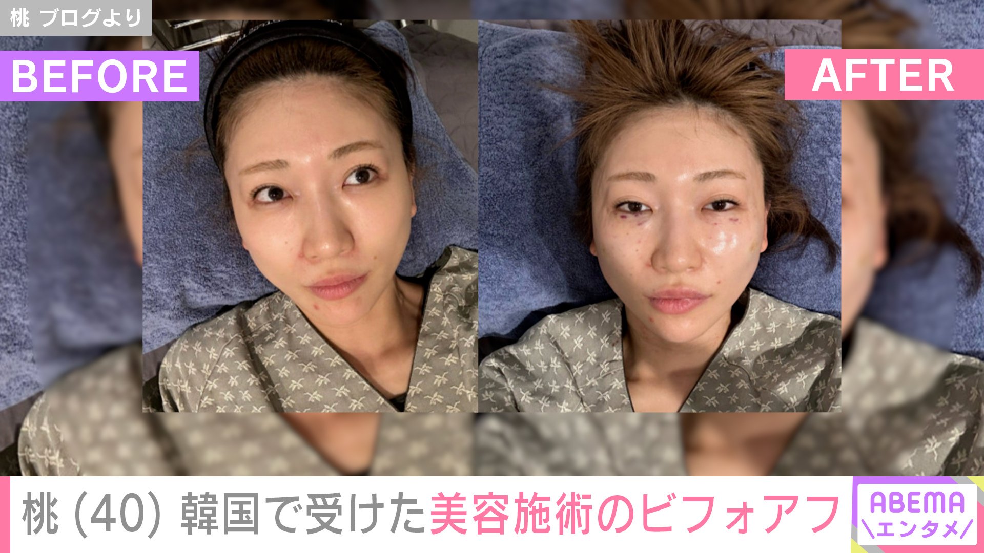 顔のビフォーアフター