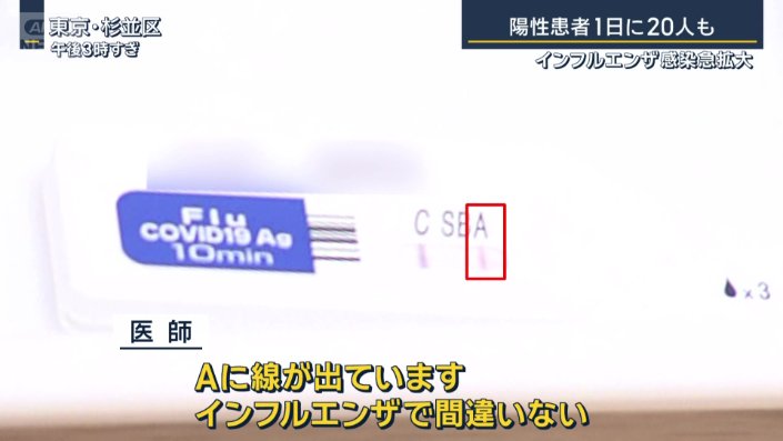 インフルエンザA型