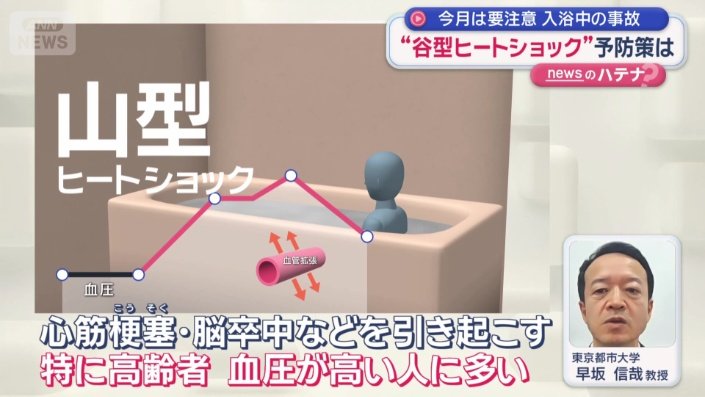 山型ヒートショック