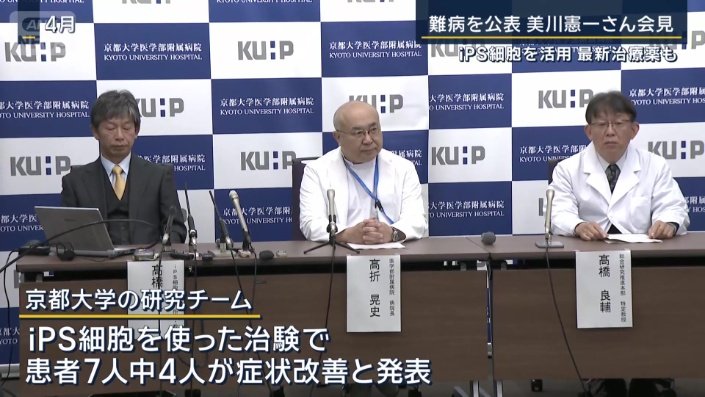 京都大学の研究チーム